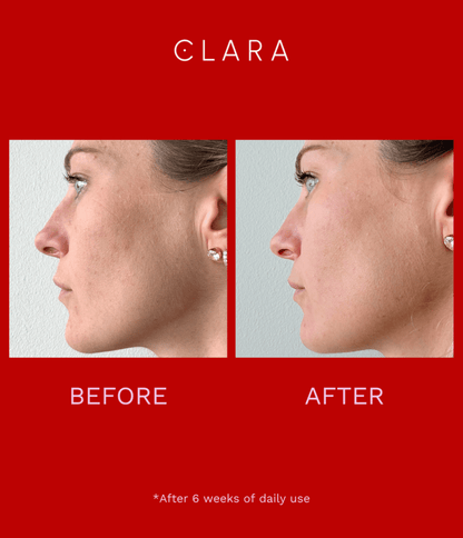 Red Light Therapy LED Face Mask, Silicone, Adjustable, Collagen Boosting Anti-Aging for Radiant Skin